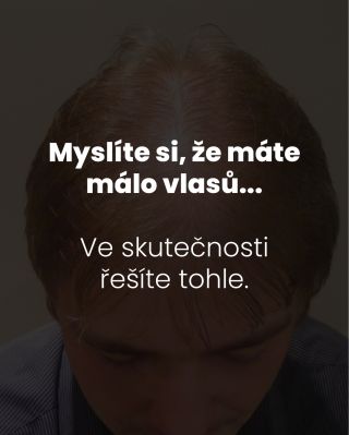 Myslíte si, že máte málo vlasů? 🤔 Možná ano. Ale možná řešíte úplně jiný problém… a zbytečně 🤷 Zkuste rychlý test 👇...