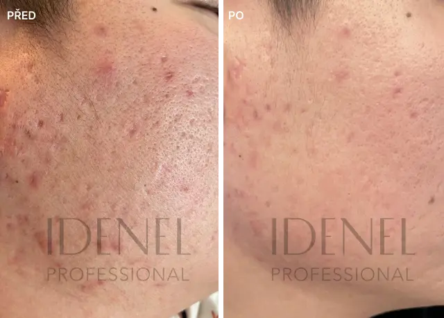 Reference před a po – IDENEL Professional