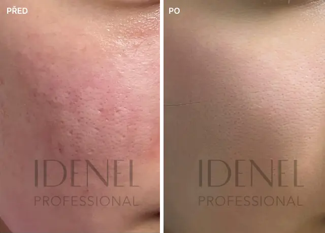Reference před a po – IDENEL Professional