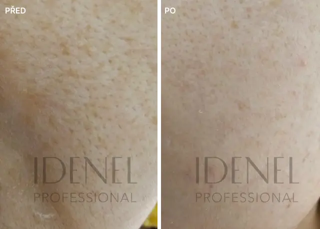 Reference před a po – IDENEL Professional
