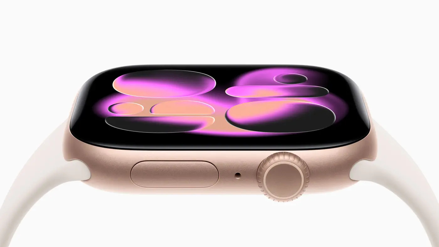 igurusk-apple-watch11-vykup-servis-predaj-inteligentnych-hodiniek