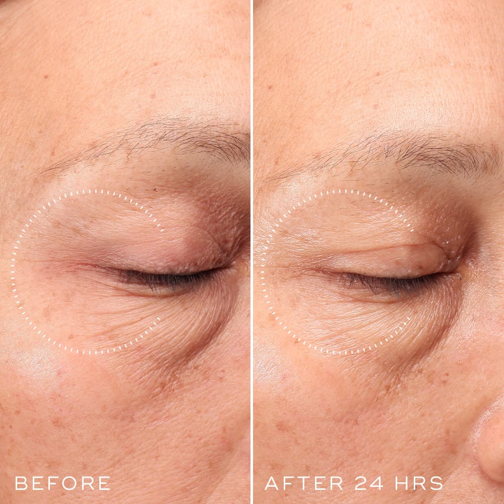 20230203-Crystal-Retinal-Ceramide-Eye-Extended-Product-Page-Assets-Before-and-After-24-hrs-2-1000-x-1000-For-Web