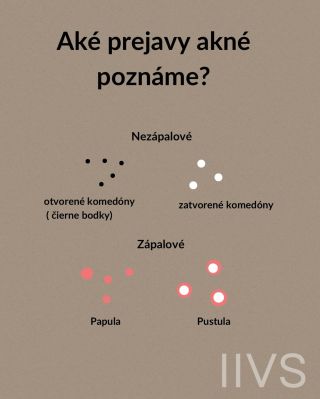 Aké prejavy akné poznáme? 🔍 Akné nie je len “jedna vyrážka” — má viacero foriem a každá si vyžaduje iný prístup. Komedóny...
