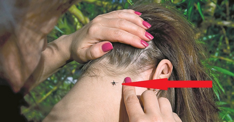 Kliešte - zdravotný problém pre návštevníkov prírody. Ako s nimi zatočiť – hlavne nimi netočiť