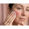 Papulo clear & calm toner iloveme
