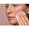 Redneskin phytoactive toner iloveme