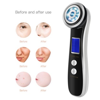 LuminaLift 4v1 – prístroj na omladenie, spevnenie a regeneráciu pleti s LED, RF, EMS a mikrovibráciou