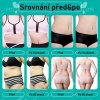 LipoShape 4D Estetická revolúcia v neinvazívnom chudnutí a spevnení pleti
