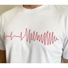 EKG tričko pánské bílé - komorová fibrilace (Velikost XS)