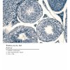 Detail popisku histologického trička varlata