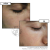 boosterserum 06