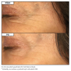 R3 Cell Matrix Mask (5)
