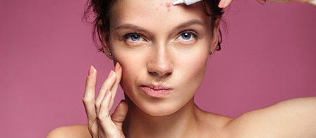 Ako sa rýchlo zbaviť akné?