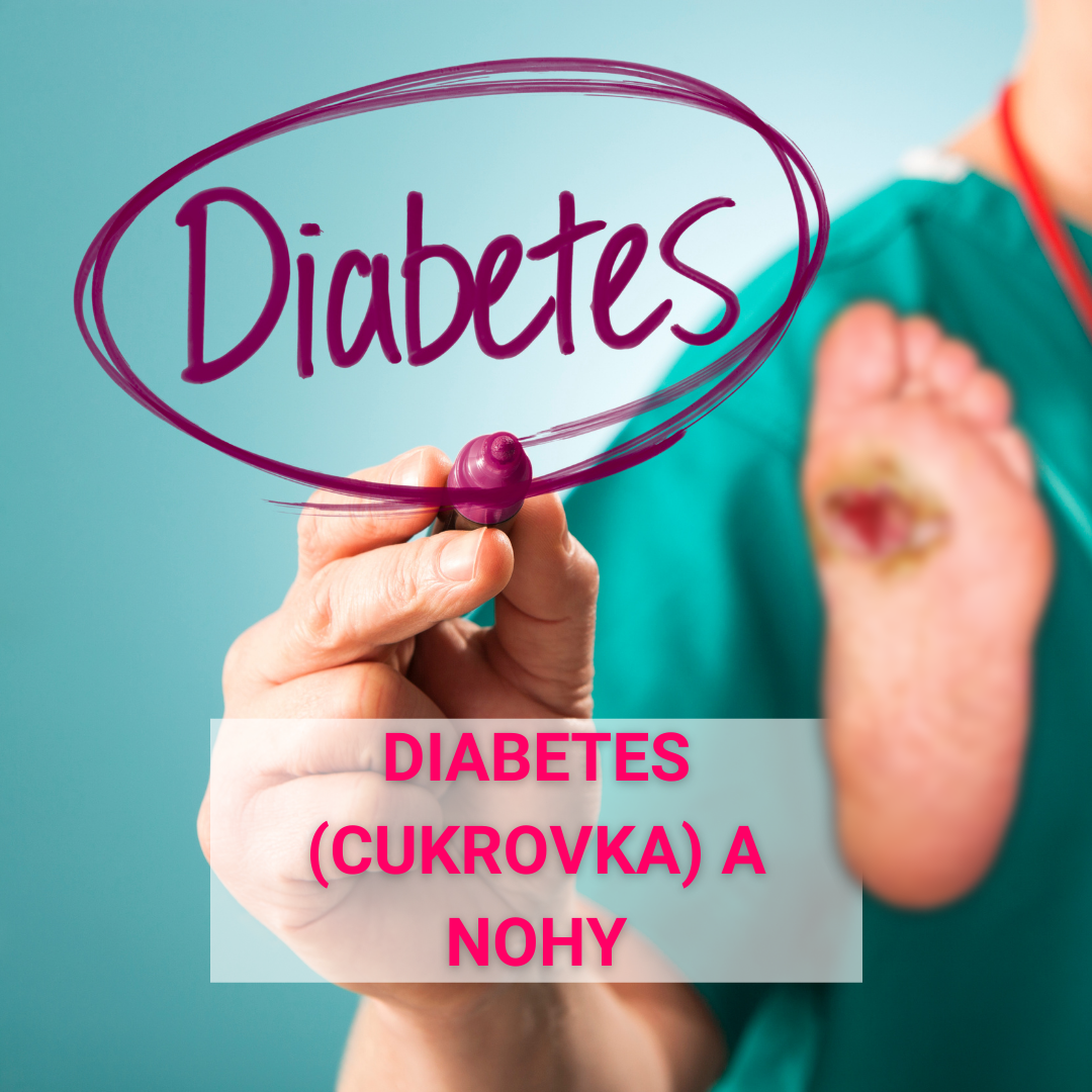 Diabetes (cukrovka) a problémy nôh