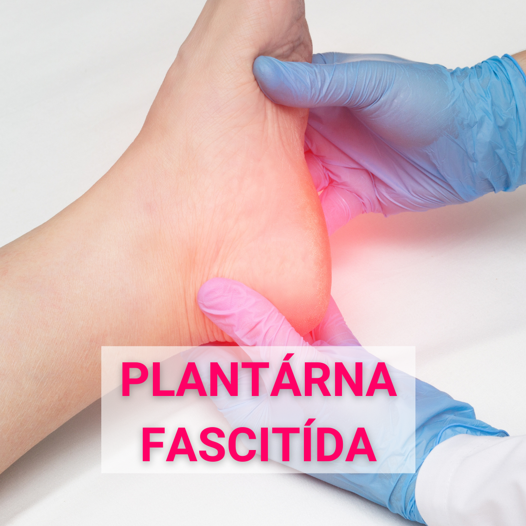 Plantárna fascitída