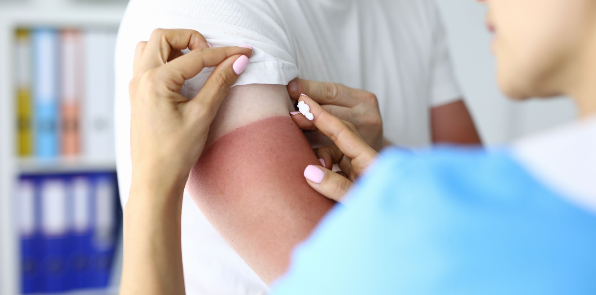 Co pomáhá na popáleniny prvního stupně: první pomoc a ošetření