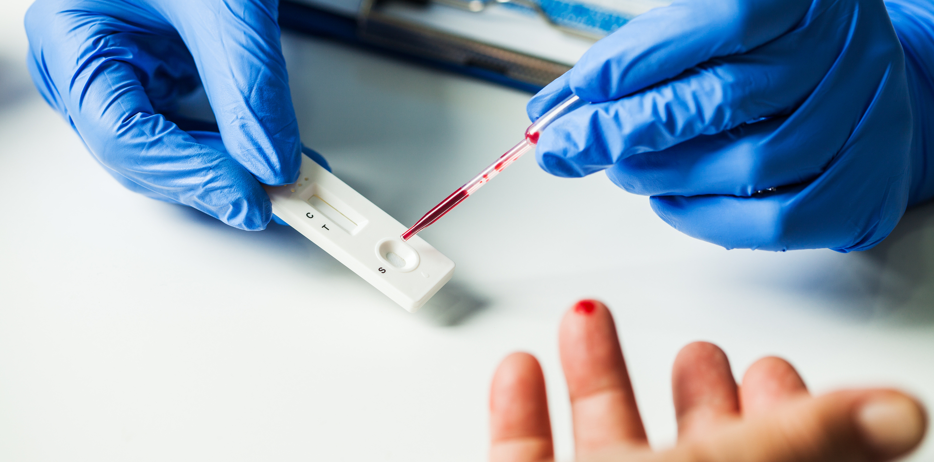 Co je CRP test a kdy ho doporučit pacientům?