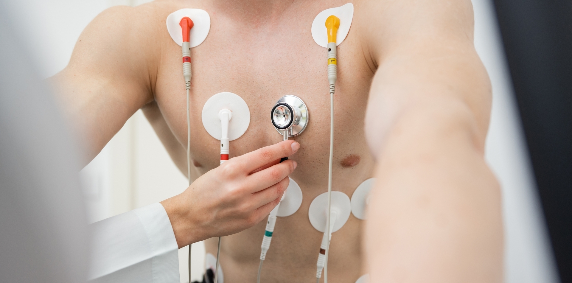 EKG elektródy – umiestnenie a typy pre presnú diagnostiku