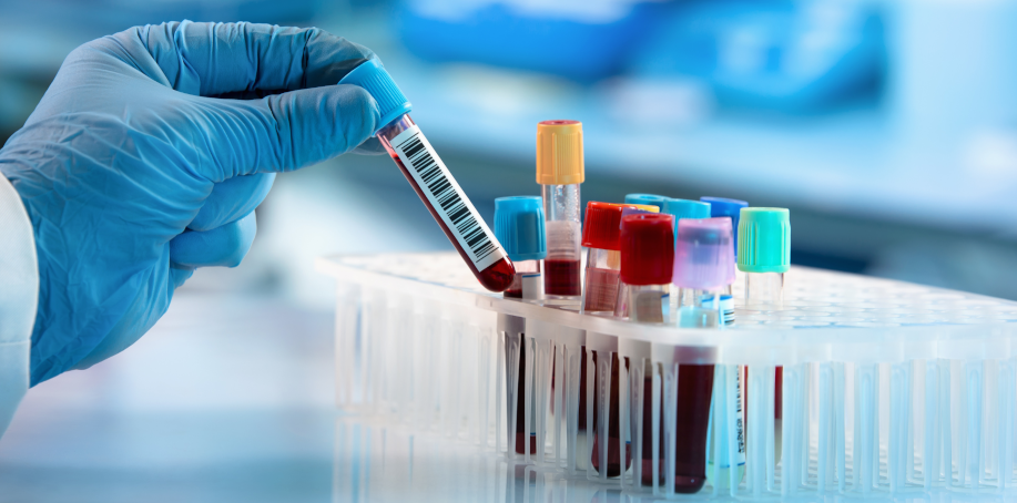 Skúmavky na krvný obraz a ich farby