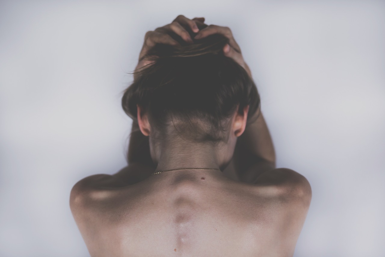 Seborea neboli seboroická dermatitida: Co to je a jaká je její léčba?