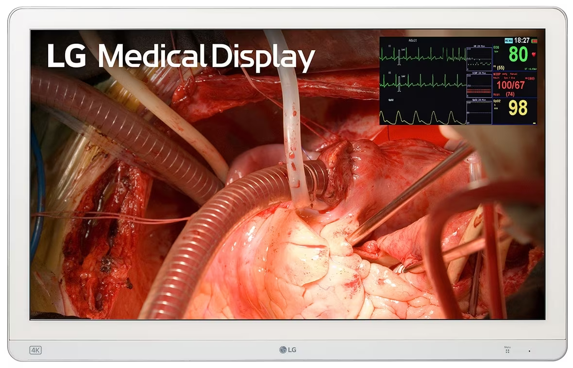 Lékařský monitor LG 27HQ710S-W / 27" (69 cm) / 4K Ultra HD / doba odezvy 5 ms / bílá Varianta: ivi1
