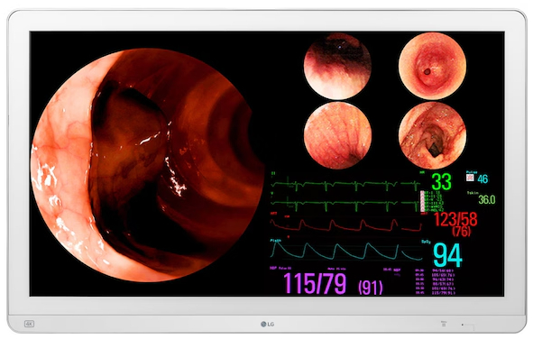 Lékařský monitor LG 32HL710S-W / 31,5" (80 cm) / 4K Ultra HD / doba odezvy 14 ms / bílá Varianta: ivi1
