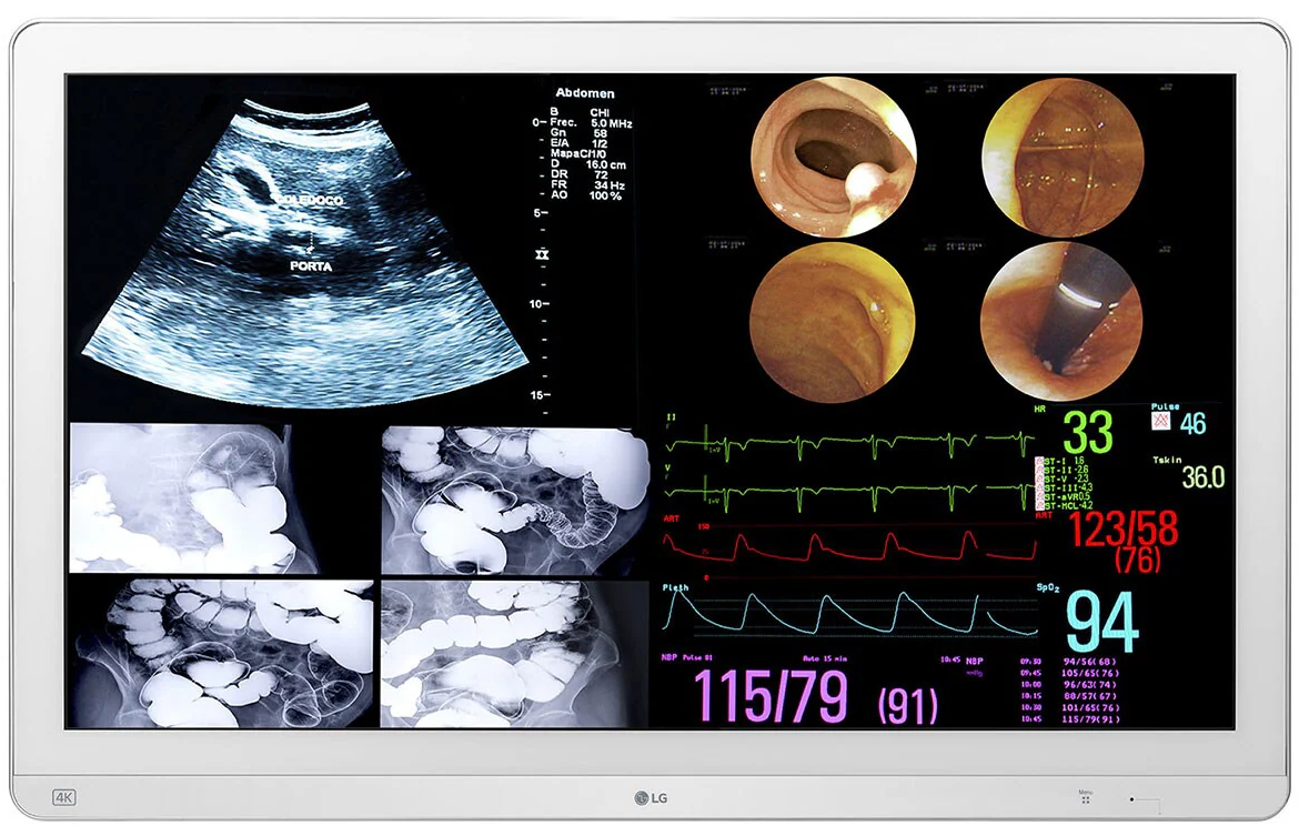 Lékařský monitor LG 32HL714S-W / 31,5" (80 cm) / 4K Ultra HD / doba odezvy 14 ms / bílá Varianta: ivi2