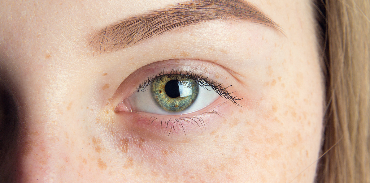 Brightening Serum a Brightening Cream: správná dvojka nejen na pigmentaci