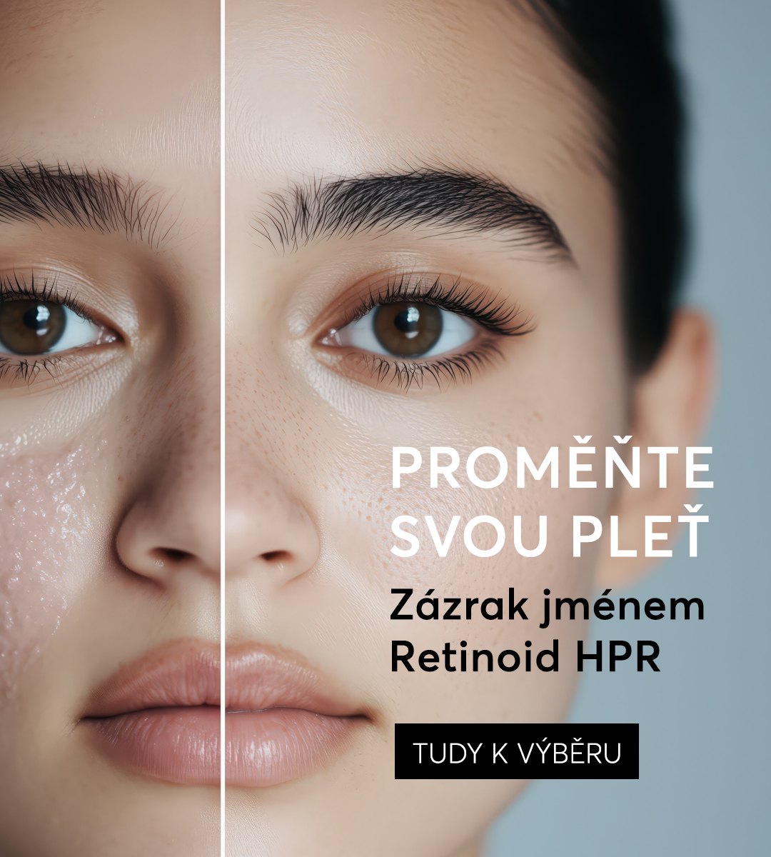 Retinoid HPR mob