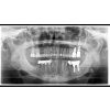 110200 5 img image x ray orthophos sl 2d program p1 2