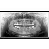 110200 6 img image x ray orthophos sl 2d program p1 1