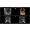 110200 8 img image screen sidexis 4 4 orthophos 5x5 low dose tooth position