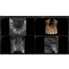 img image screen sidexis 4 4 orthophos 5x5 low dose tooth position