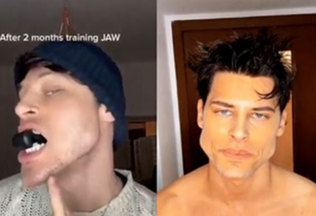 Model si extrémně vyrýsoval svůj obličej -> iDnes.cz