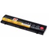 Baterie T6 Power pro Lenovo ThinkPad L560, L570, 5200mAh, 56Wh, 6cell