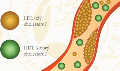 Joda ORGANIKA® UPRAVUJE CHOLESTEROL (KLINICKÁ STUDIE)