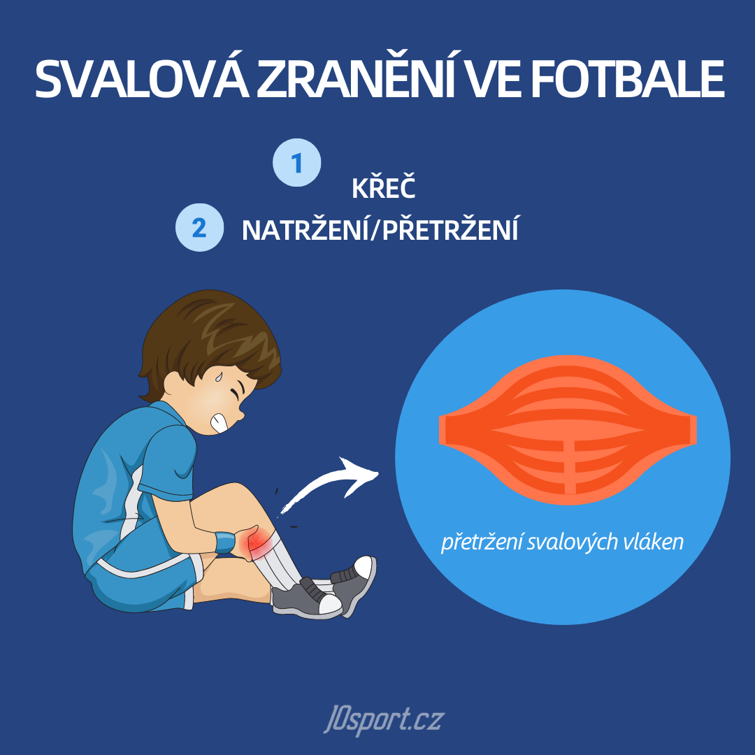 Nejčastější svalová zranění ve fotbale