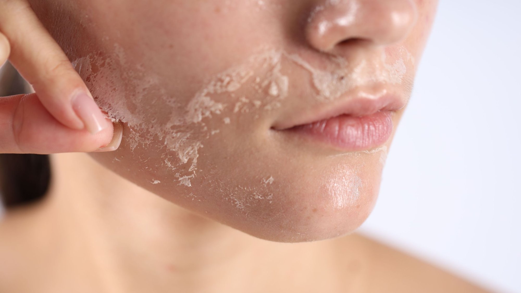 Jak posílit kožní bariéru a zklidnit citlivou pleť?