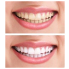 Bieliace pásiky Bright White, 28 ks