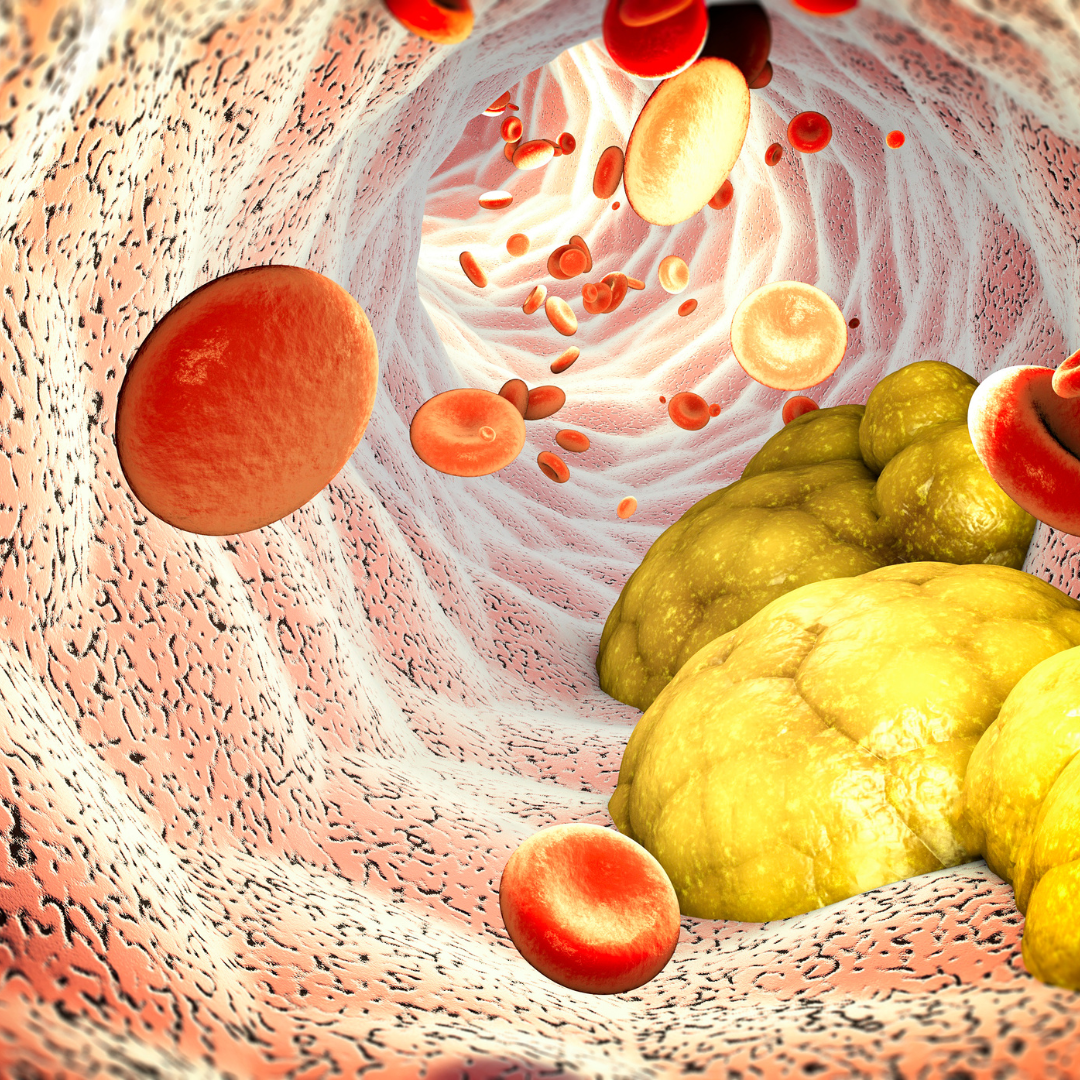 Strašák vysoký cholesterol: komplexní pohled a řešení přírodní cesotu