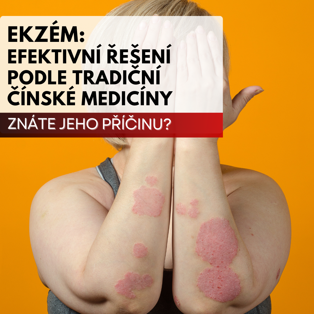 Ekzém z pohledu tradiční čínské medicíny (TČM)
