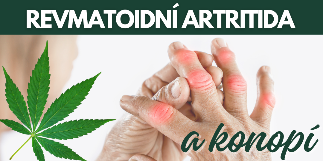 CBD a Revmatoidní Artritida: Jak Konopné Produkty Mohou Pomoci Snížit Bolest a Zánět