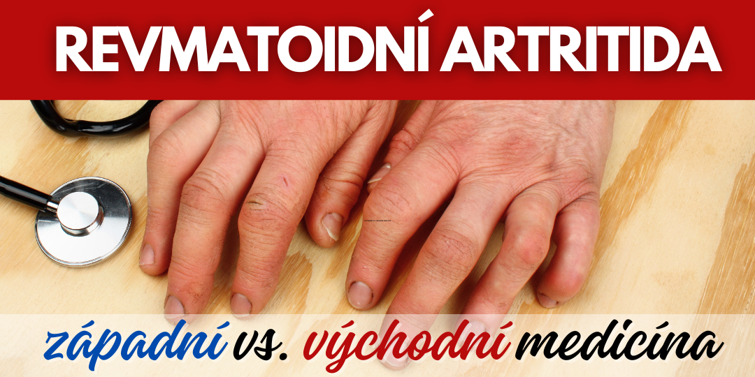 Revmatoidní Artritida: Srovnání Přístupů Západní a Východní Medicíny