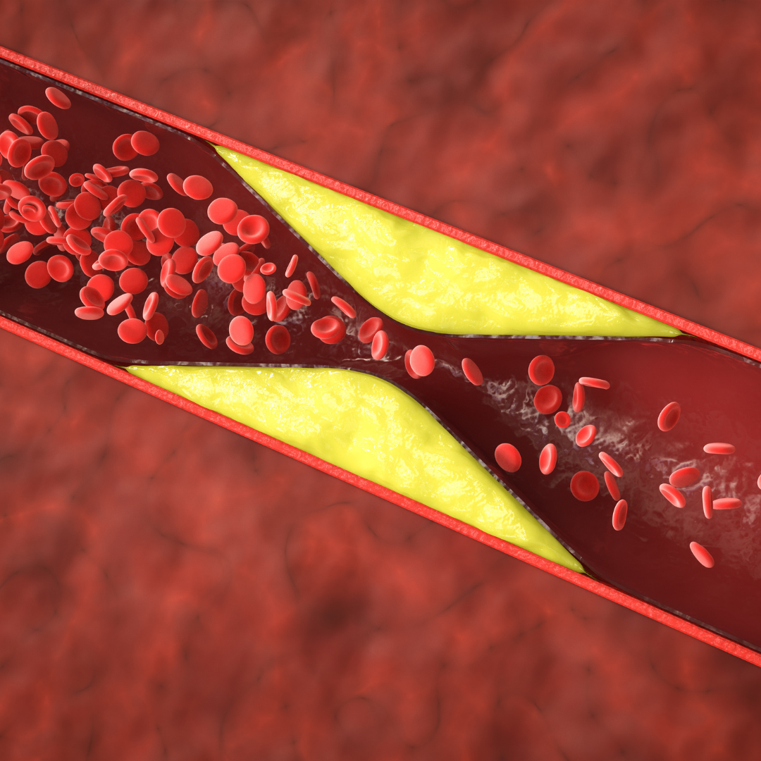 Cukr, tlak, cholesterol
