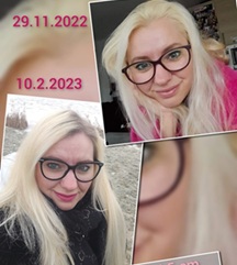 Zázrak na zničené vlasy i nehty