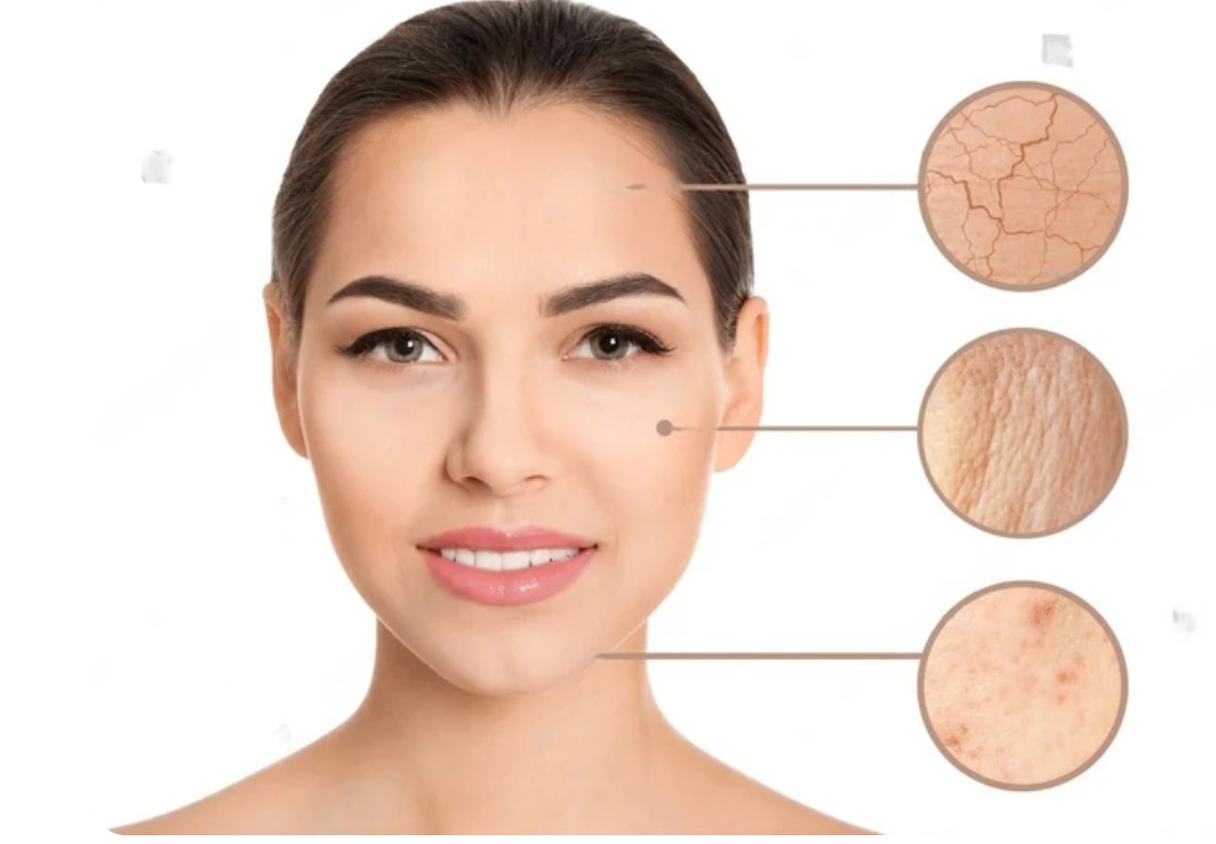 TYPY PLETI: seznam se se svou pokožkou