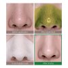Bye Bye Blackhead Miracle Green Tea Tox Bubble Cleanser4