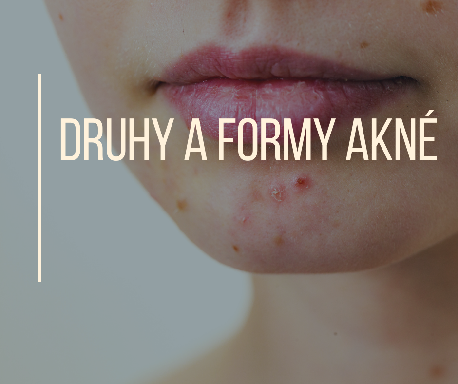 DRUHY A FORMY AKNÉ