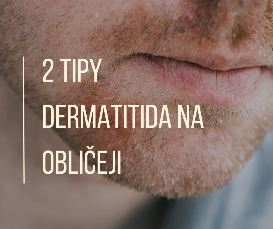 2 tipy na dermatitidu na obličeji
