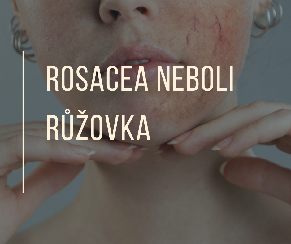 ROSACEA NEBOLI RŮŽOVKA